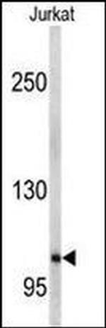 EphA5 Antibody in Western Blot (WB)