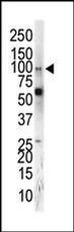 EphA5 Antibody in Western Blot (WB)