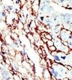 EphA7 Polyclonal Antibody