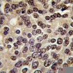 PKN3 Polyclonal Antibody