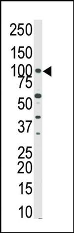 PKN3 Antibody in Western Blot (WB)