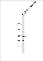 LTK Polyclonal Antibody
