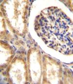 MCK10 Polyclonal Antibody