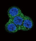 PDGFRB Polyclonal Antibody