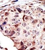 RYK Polyclonal Antibody