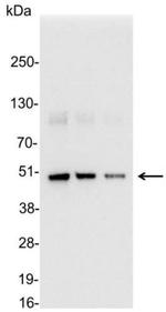 Enterokinase Cleavage Site Antibody in Western Blot (WB)