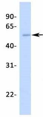 NR5A1 Antibody in Western Blot (WB)