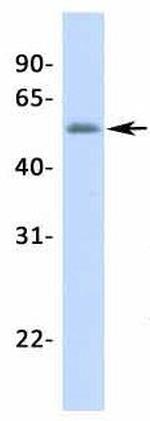 NR5A1 Antibody in Western Blot (WB)
