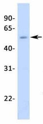 NR5A1 Antibody in Western Blot (WB)