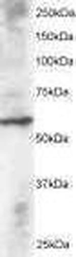 DUSP8 Antibody in Western Blot (WB)