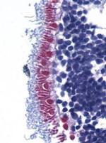 AIF Antibody in Immunohistochemistry (IHC)