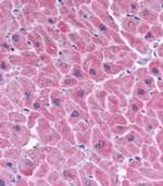 ARC Antibody in Immunohistochemistry (Paraffin) (IHC (P))
