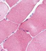 ARC Antibody in Immunohistochemistry (Paraffin) (IHC (P))