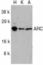 ARC Antibody in Western Blot (WB)