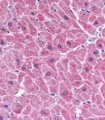 ARC Antibody in Immunohistochemistry (IHC)