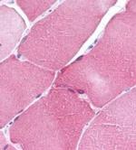 ARC Antibody in Immunohistochemistry (IHC)