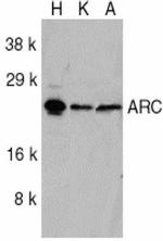 ARC Antibody in Western Blot (WB)