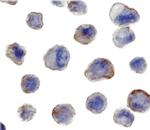 MADD Antibody in Immunocytochemistry (ICC/IF)
