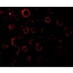 MADD Antibody in Immunocytochemistry (ICC/IF)
