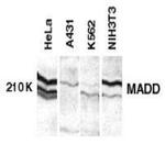 MADD Antibody in Western Blot (WB)