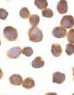 ZIPK Antibody in Immunocytochemistry (ICC/IF)