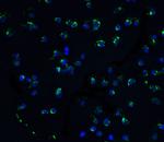 ZIPK Antibody in Immunocytochemistry (ICC/IF)