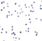 ZIPK Antibody in Immunocytochemistry (ICC/IF)