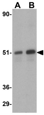 ZIPK Antibody in Western Blot (WB)