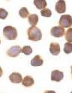 ZIPK Antibody in Immunocytochemistry (ICC/IF)