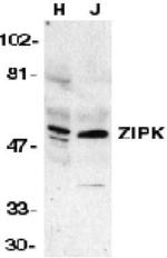 ZIPK Antibody in Western Blot (WB)