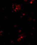 CD263 (TRAIL-R3) Antibody in Immunocytochemistry (ICC/IF)