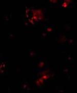 CD263 (TRAIL-R3) Antibody in Immunohistochemistry (IHC)