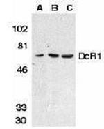 CD263 (TRAIL-R3) Antibody in Western Blot (WB)