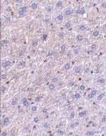 F1A alpha Antibody in Immunohistochemistry (Paraffin) (IHC (P))