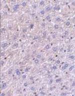 F1A alpha Antibody in Immunohistochemistry (IHC)