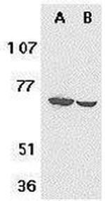 F1A alpha Antibody in Western Blot (WB)