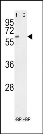 RYK Antibody in Western Blot (WB)