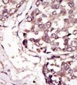 RYK Antibody in Immunohistochemistry (Paraffin) (IHC (P))