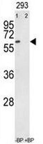 RYK Antibody in Western Blot (WB)