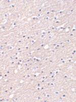 CIDEA Antibody in Immunohistochemistry (Paraffin) (IHC (P))