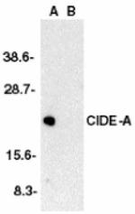 CIDEA Antibody in Western Blot (WB)