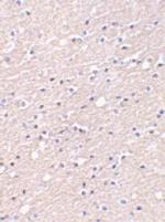 CIDEA Antibody in Immunohistochemistry (IHC)