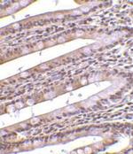 PHAP Antibody in Immunohistochemistry (IHC)