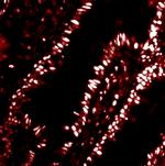 PHAP Antibody in Immunohistochemistry (Paraffin) (IHC (P))