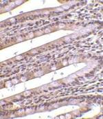 PHAP Antibody in Immunohistochemistry (IHC)