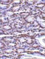 PHAP I Antibody in Immunohistochemistry (Paraffin) (IHC (P))