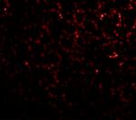 PHAP I Antibody in Immunohistochemistry (Paraffin) (IHC (P))