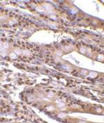 PHAP III Antibody in Immunohistochemistry (Paraffin) (IHC (P))