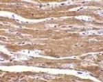 BACE2 Antibody in Immunohistochemistry (IHC)