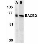 BACE2 Antibody in Western Blot (WB)